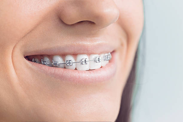 Dental Bonding in Austin, AR
